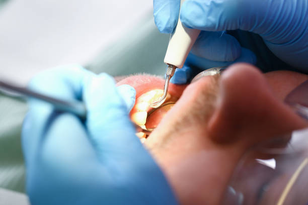 Best Emergency Dentist for Lost Fillings or Crowns in Lorenzo, TX