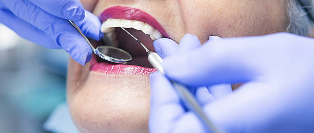 Best Emergency Dentist for Lost Fillings or Crowns in Lorenzo, TX
